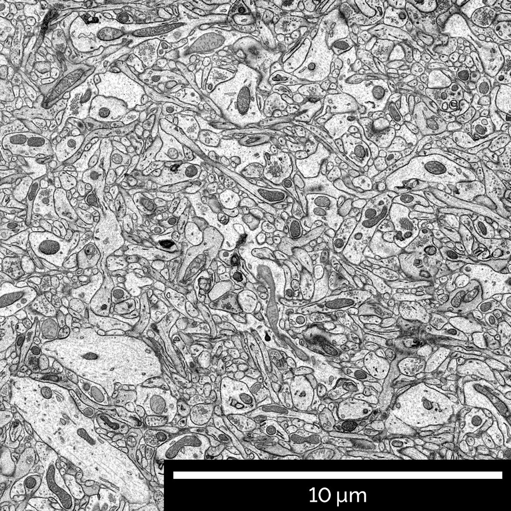 Large overview image of resin embedded brain tissue imaged with Low-energy chamber BSE detector at accelerating voltage 2 keV