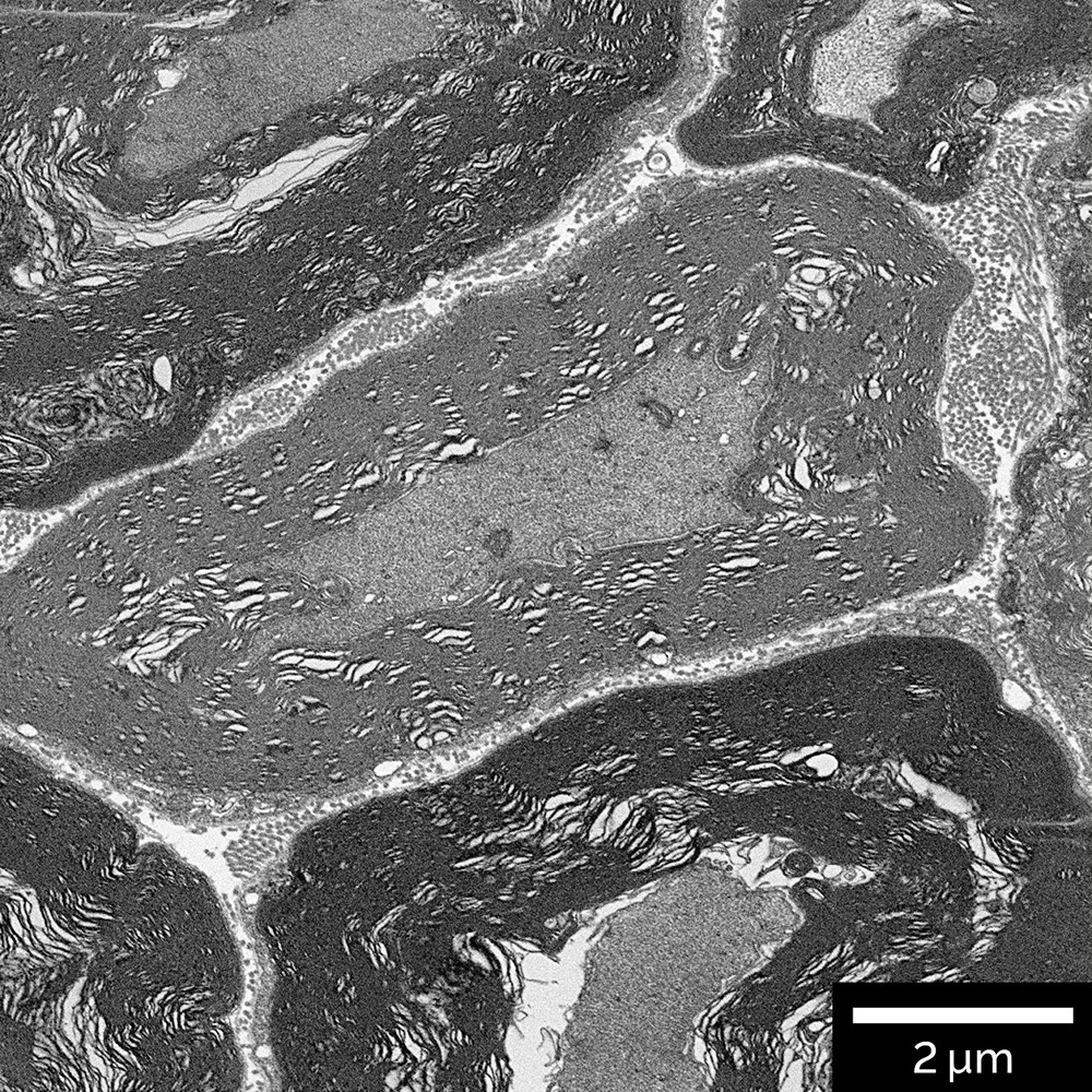 Resin embedded brain tissue. The ultrastructure were visualized using In-Beam BSE detector at accelerating voltage of 2 keV