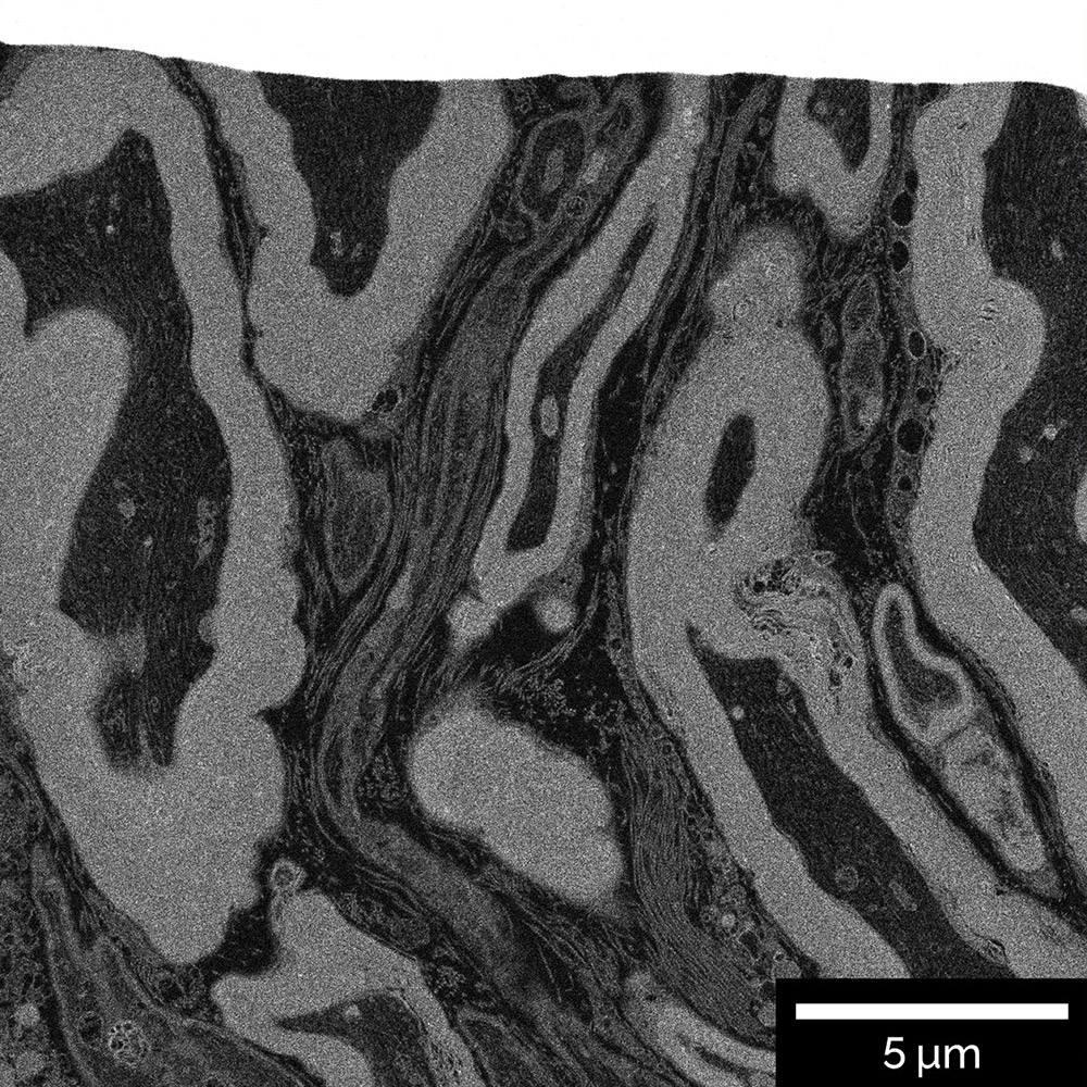 Resin embedded brain tissue. Cross-section was prepared with Ga FIB and visualized using In-Beam BSE detector